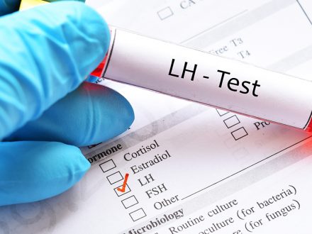 كل شيء عن LH (هرمون ملوتن) واختبار LH