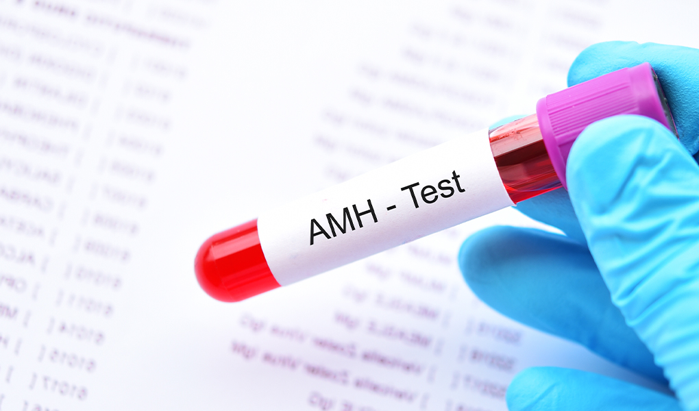 ما هو اختبار AMH؟ ماذا يجب أن تكون قيمة AMH؟