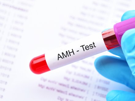 Was ist der AMH – Test? Wie hoch sollte der AMH – Wert sein?
