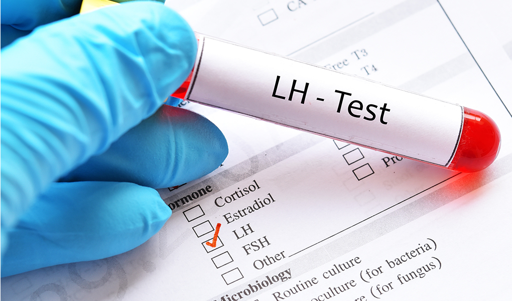 All About LH (Luteinizing Hormone) and LH Test