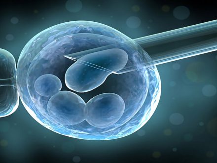 Metoda e Tubimit Në Trajtimin e Infertilitetit – Tubimi i Embrioneve