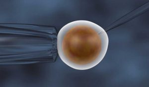 Sperm Hücrelerinin Mikroenjeksiyon Sırasında Yüksek Büyütme ile Seçilmesi (IMSI)