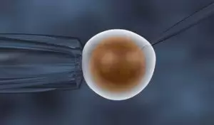 Sperm Hücrelerinin Mikroenjeksiyon Sırasında Yüksek Büyütme ile Seçilmesi (IMSI)