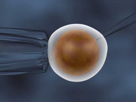 Sperm Hücrelerinin Mikroenjeksiyon Sırasında Yüksek Büyütme ile Seçilmesi (IMSI)