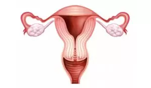 Какво означава превръзка на тръбите и как се прави?