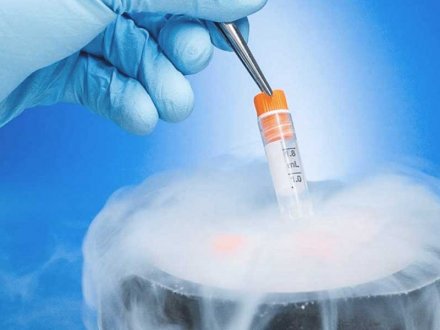 Dondurulmuş Embriyo Transferi Nedir & Transfer Aşamaları