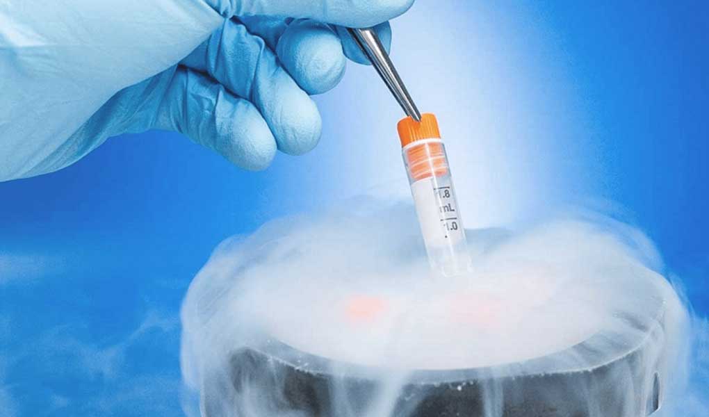 Dondurulmuş Embriyo Transferi Nedir & Transfer Aşamaları