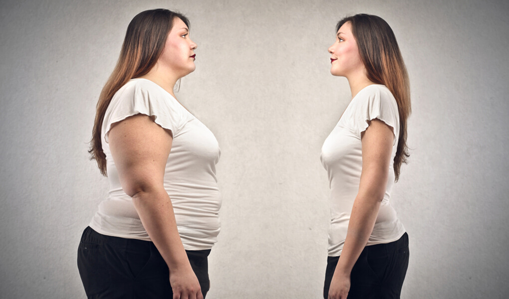 Obezite (Şişmanlık) Kısırlığa Yol Açar mı?
