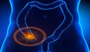 Apandisit Nedir ve Belirtileri Nelerdir?