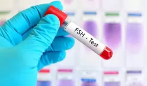 What Is FSH Hormone? What Is the Ideal FSH Level?