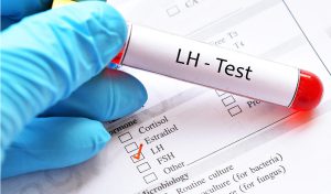 LH (Luteinizing Hormon) ve LH Testi Hakkında Her Şey