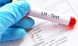 All About LH (Luteinizing Hormone) and LH Test