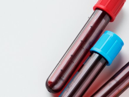 Kan Uyuşmazlığı Testi (İndirekt Coombs) Nedir?