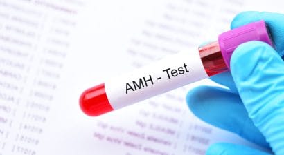 Amh Testi Nedir Amh Değeri Kaç Olmalıdır?