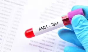 What Is AMH Test? What Is the Ideal AMH Level?