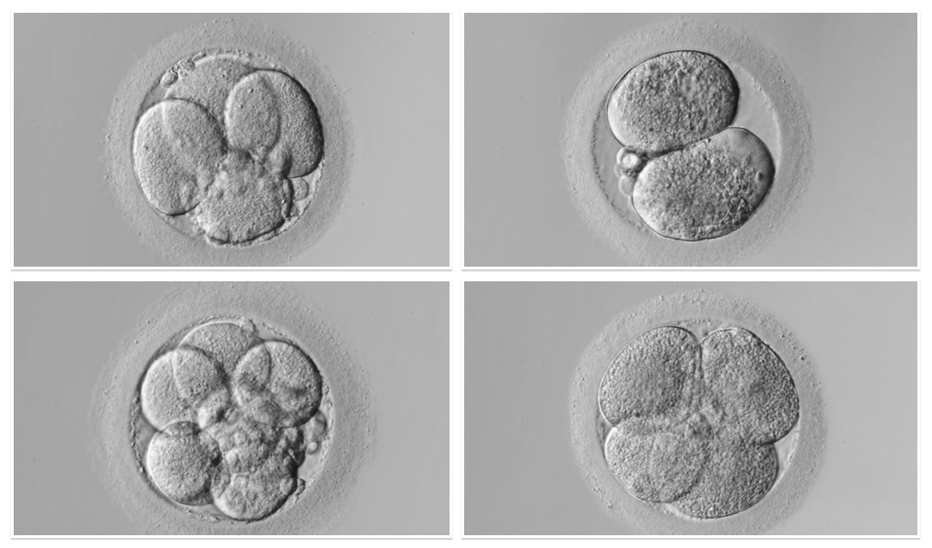 3. Gün 5. Gün ve 6. Gün Embriyosu Ne Demektir?