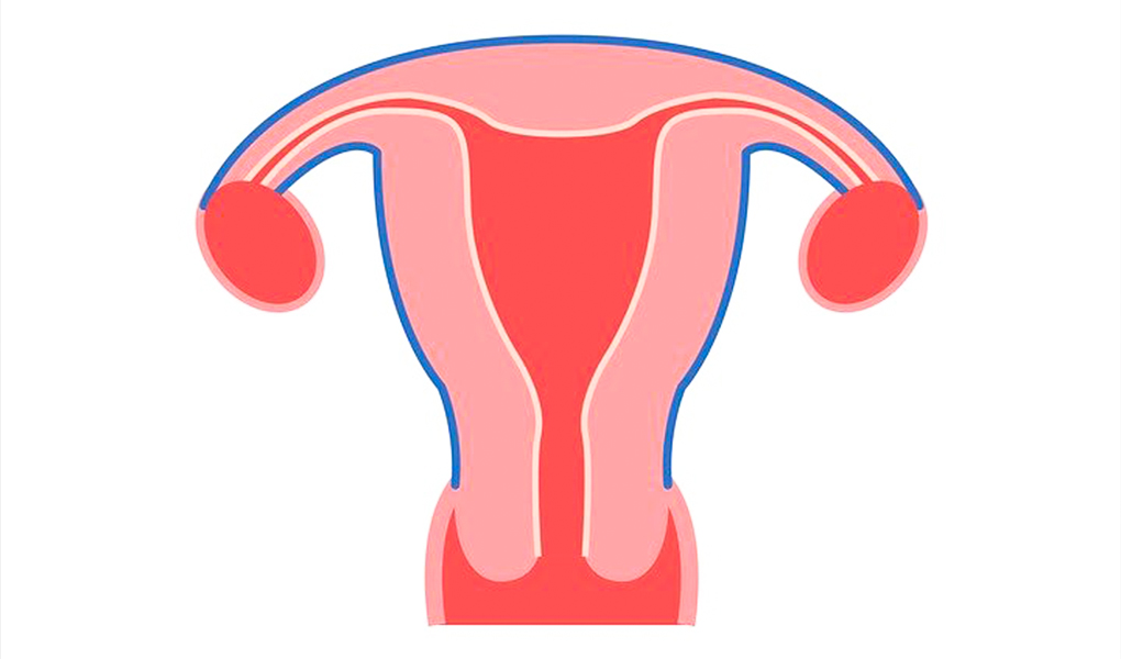T Şeklinde Rahim Nedir, Neden Olur ve Tedavisi