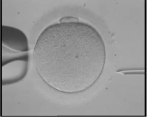 Асистиран хетчинг с лазер