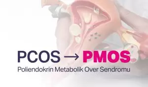 PCOS Artık PMOS: Poliendokrin Metabolik Over Sendromu Hakkında Bilmeniz Gerekenler